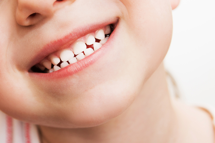My child has a knocked out baby tooth What do I do? Smile Solutions Article
