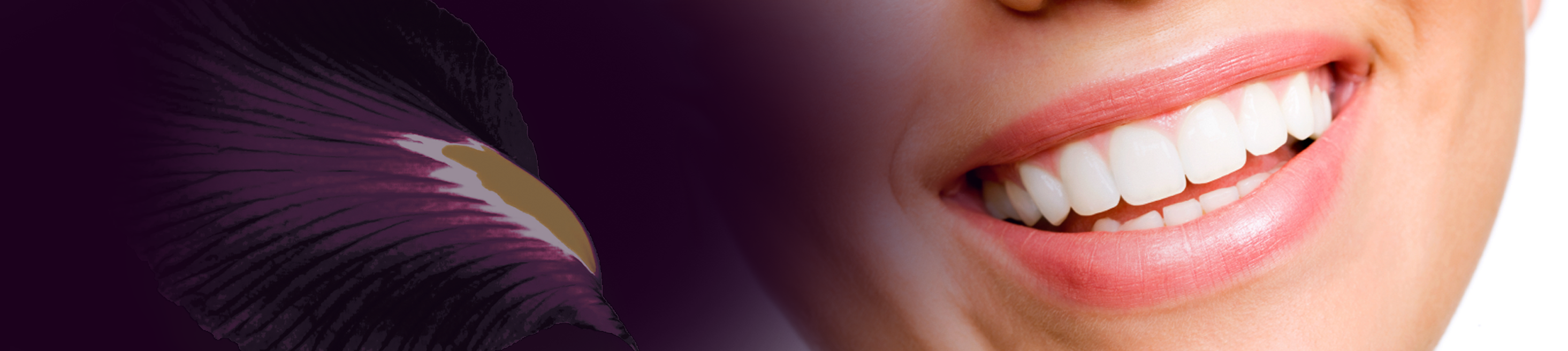 Teeth Whitening Melbourne Smile Solutions